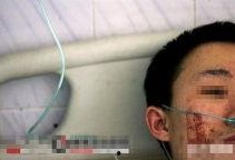 秃头最新爆料,揭秘明星脱发背后的真相